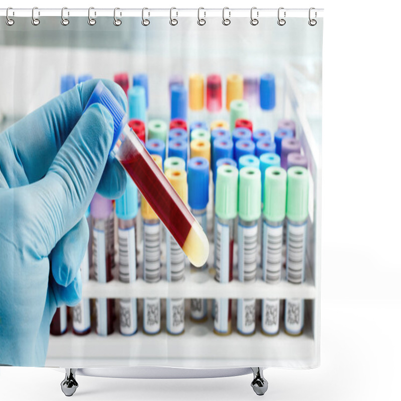 Personality  Laboratory Technician Holding A Blood Tube Test Shower Curtains