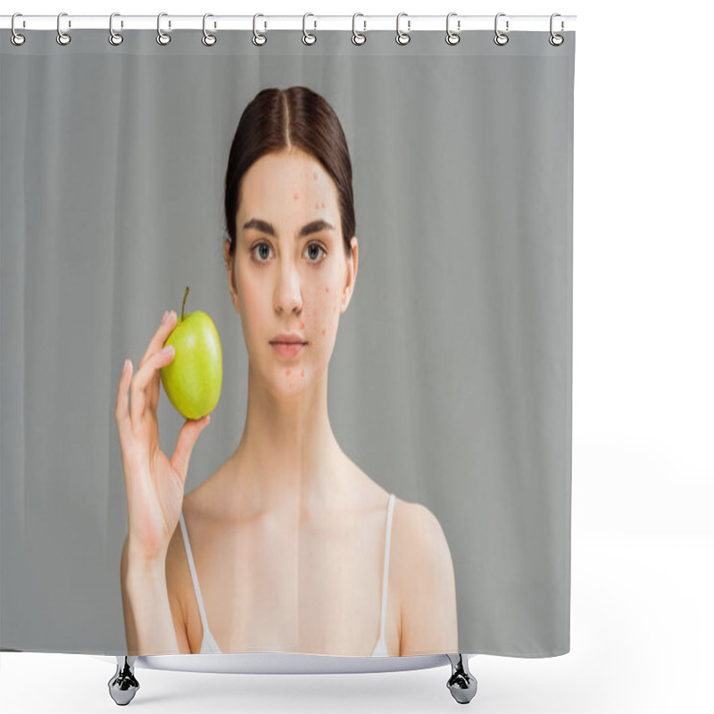 Personality   Young Woman With Pimples On Face Holding Green Apple Isolated On Grey  Shower Curtains