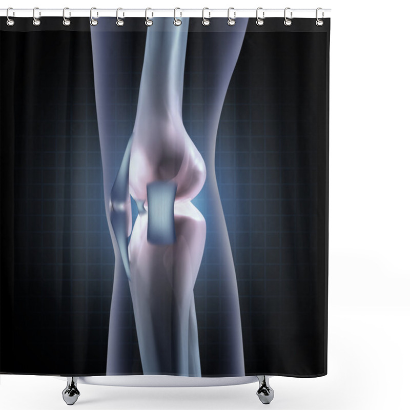 Personality  Knee Anatomy Shower Curtains