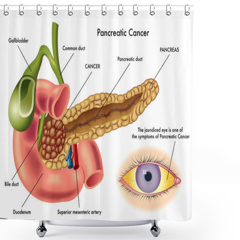 Personality  Pancreatic Cancer Scheme Shower Curtains