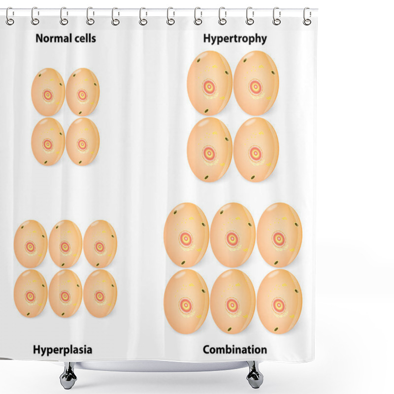 Personality  Difference Hyperplasia, Hypertrophy And Normal Cells Shower Curtains