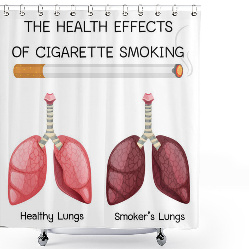 Personality  Poster On Health Effects Of Cigarette Smoking Illustration Shower Curtains