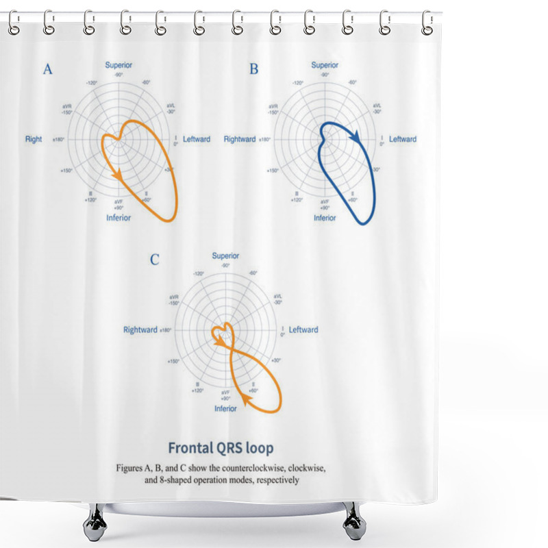 Personality  During Ventricular Depolarization, A Spatial QRS Loop Is Generated, Projected Onto The Frontal Lead System, Forming The Frontal QRS Loop, Which Further Forms The Electrocardiogram. Shower Curtains