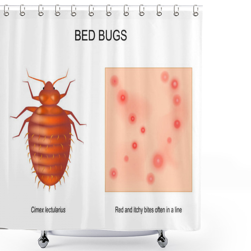 Personality  Bed Bug. Adult Female Of Cimex Lectularius. Close-up Of Skin With Red And Itchy Bites That Often In A Line. Magnification Of An Insect. Top View Of A Bedbug. Vector Illustration Shower Curtains