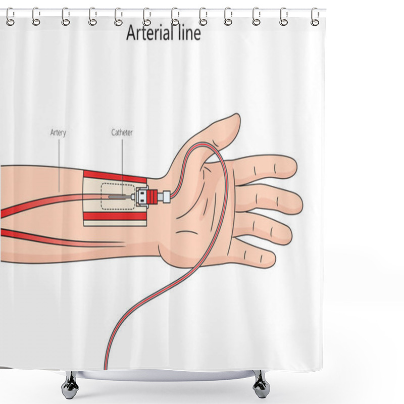 Personality  Arterial Line Structure Thin Catheter Inserted Into An Artery Diagram Hand Drawn Schematic Raster Illustration. Medical Science Educational Illustration Shower Curtains