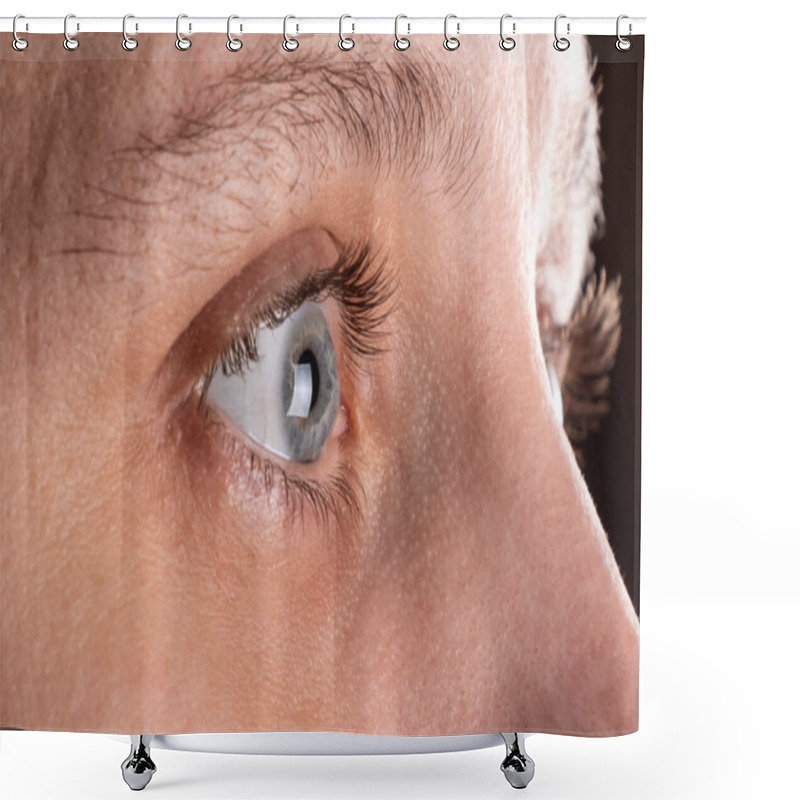 Personality  Woman Eye With Corneal Dystrophy, Keratoconus, Thinning Of The Cornea Shower Curtains