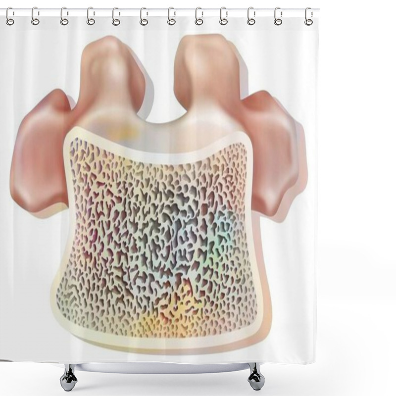 Personality  Structure Of A Healthy Dorsal Vertebra With Spongy And Compact Tissue. Shower Curtains