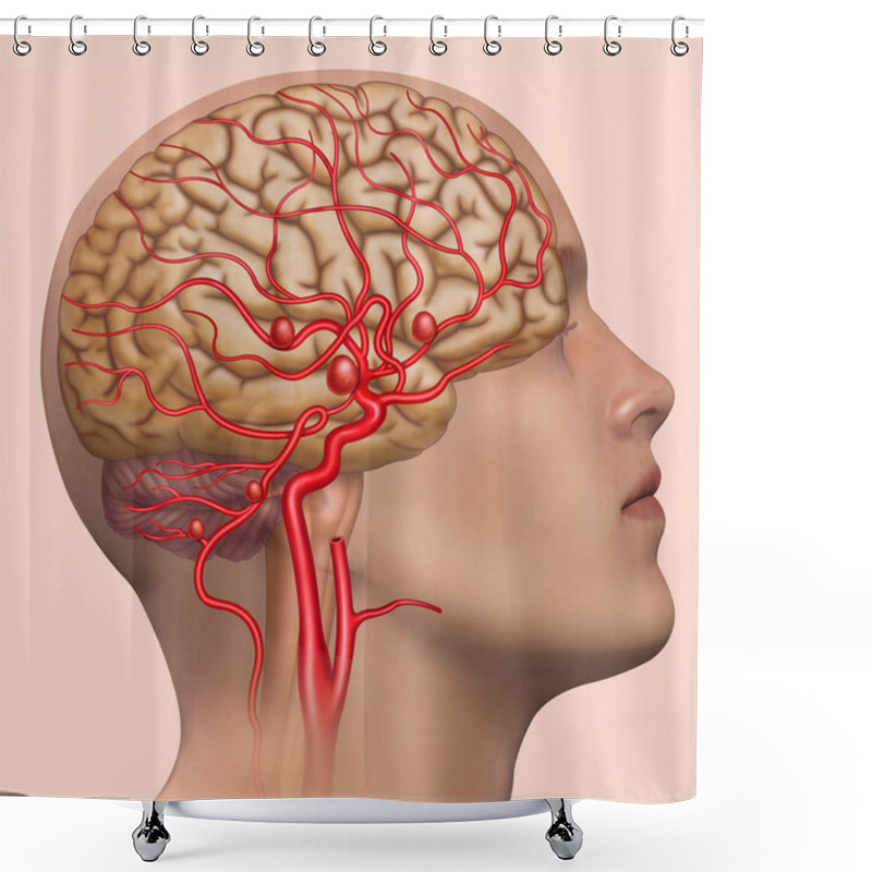 Personality  Human Head, Rendered, On A Blue Background, With An Aneurysm In The Internal Carotid Artery. Shower Curtains