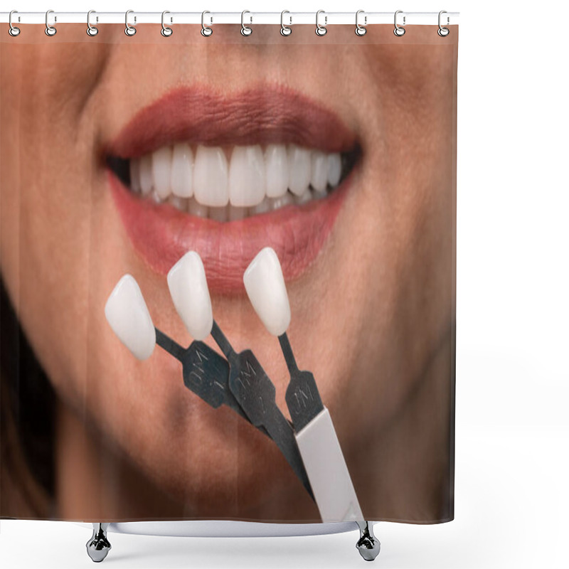 Personality  Whitening Concept. Dental Care, Implants For Veneers. Beautiful Caucasian Woman With Perfect Smile Chooses Tooth Tone In Dental Clinic. Modern Medicine. Shower Curtains