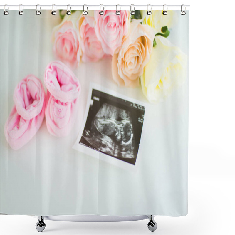 Personality  Ultrasound Picture Of A Baby With Pink Baby's Bootees Shower Curtains