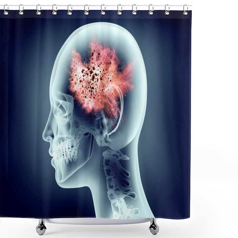 Personality  Xray Image Of Human Head With Explosion Shower Curtains