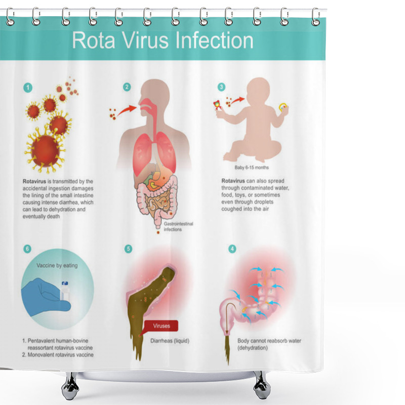 Personality  Rotavirus Is Transmitted By The Accidental Ingestion Shower Curtains