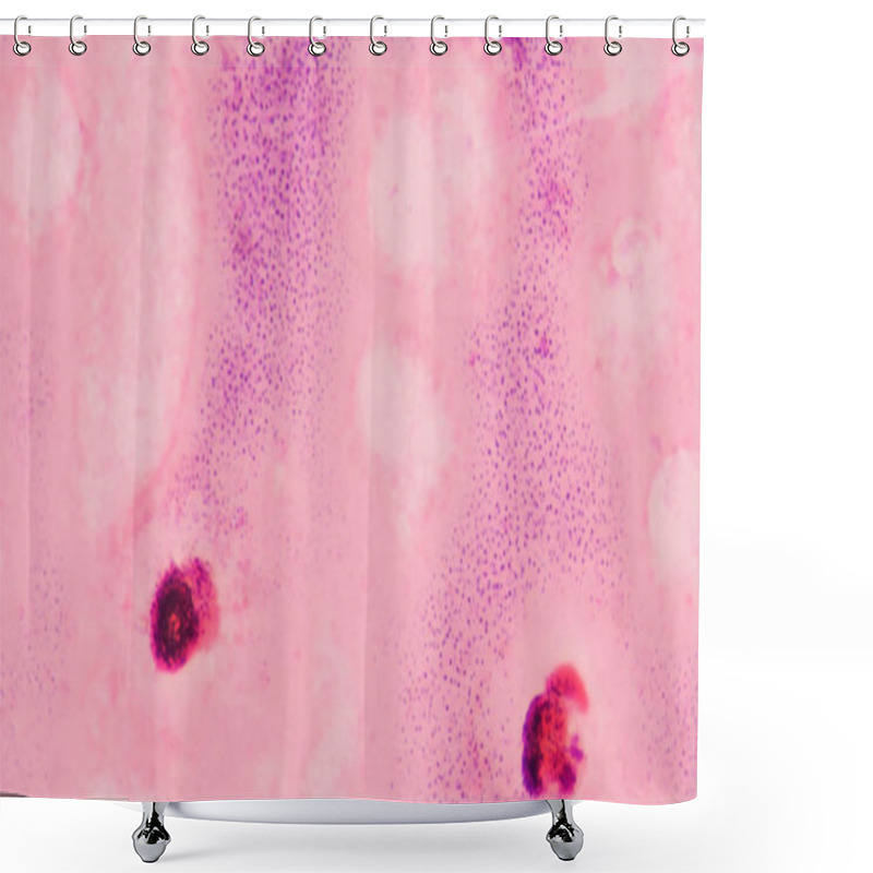 Personality  Abnormal Blood Cell Background. Shower Curtains