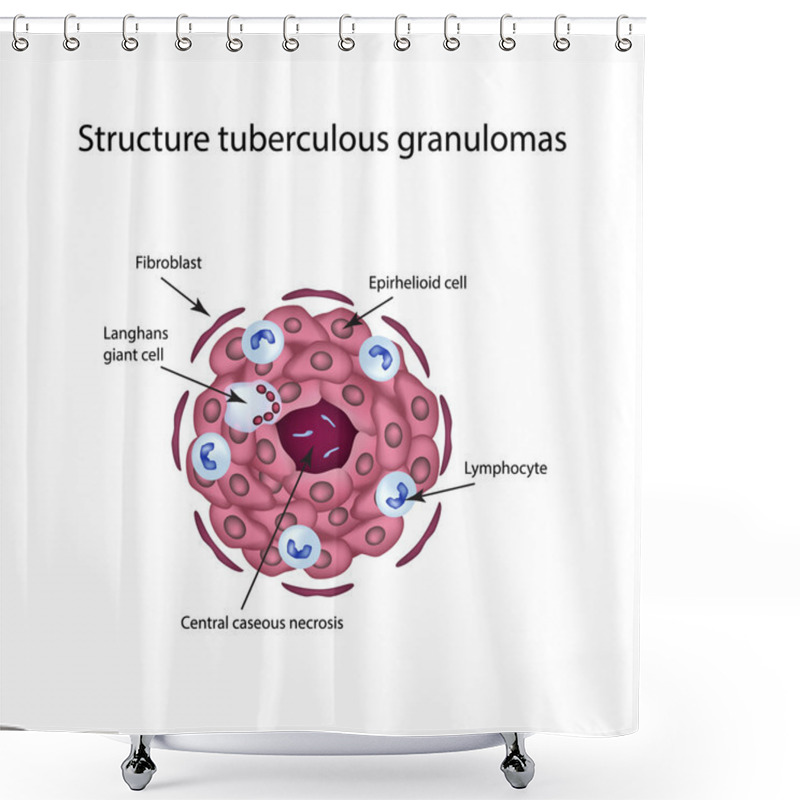 Personality  The Structure Of Tuberculous Granulomas. Vector Illustration On Isolated Background Shower Curtains