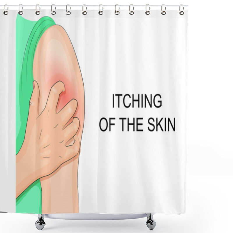 Personality  Itching Of The Skin, Infection. Hand Combing Shoulder Shower Curtains