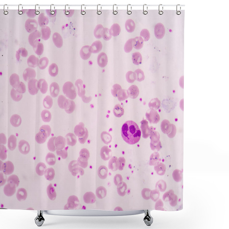 Personality  Hypersegmented Neutrophil Shower Curtains