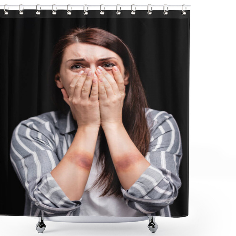 Personality  Depressed Woman With Bruises On Hands Covering Mouth Isolated On Black  Shower Curtains