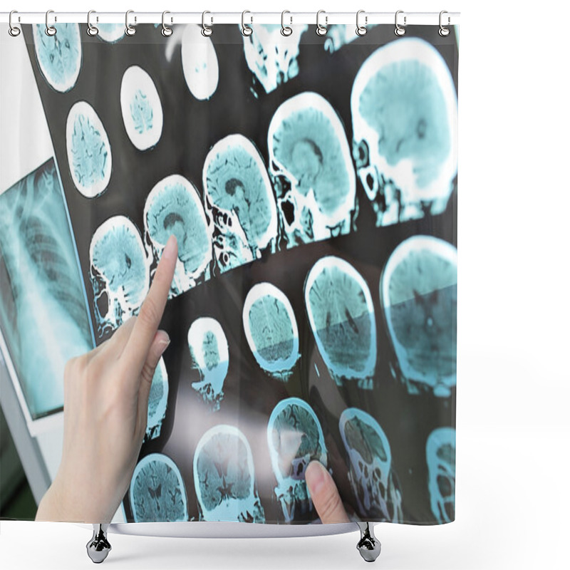 Personality  Doctor View Output CT Scan. Shower Curtains