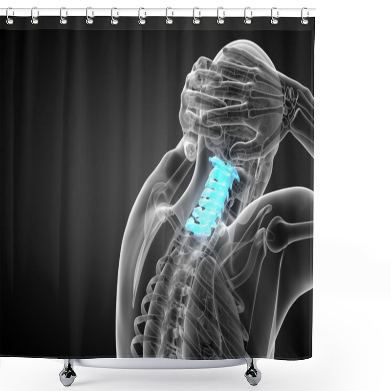 Personality  3d Render Medical Illustration Of The Cervical Spine Shower Curtains