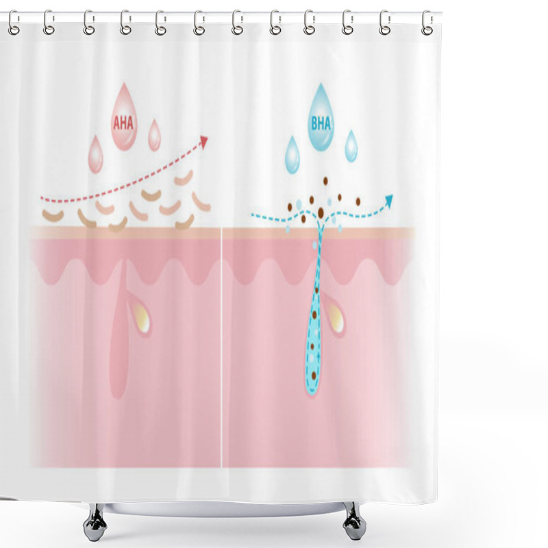 Personality  Alpha Hydroxy Acids And Beta Hydroxy Acids Characteristics Vector Illustration On White Background. AHA Exfoliate The Surface Skin And Water Soluble. BHA Penetrate Deep Into The Pore And Oil Soluble. Shower Curtains