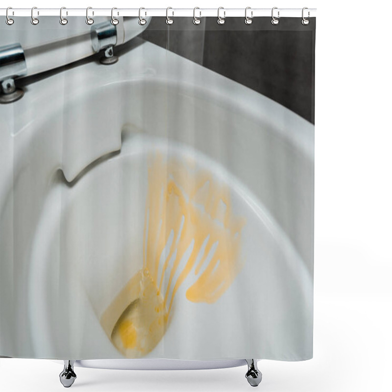 Personality  Close Up View Of Yellow Liquid Detergent In Ceramic Clean Toilet Bowl In Modern Restroom With Grey Tile Shower Curtains