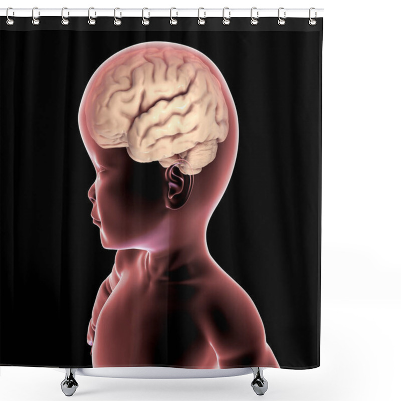 Personality  A Child With Macrocephaly And Enlarged Brain, 3D Illustration. Pathologic Macrocephaly With Megalencephaly, Genetic Disorders Shower Curtains