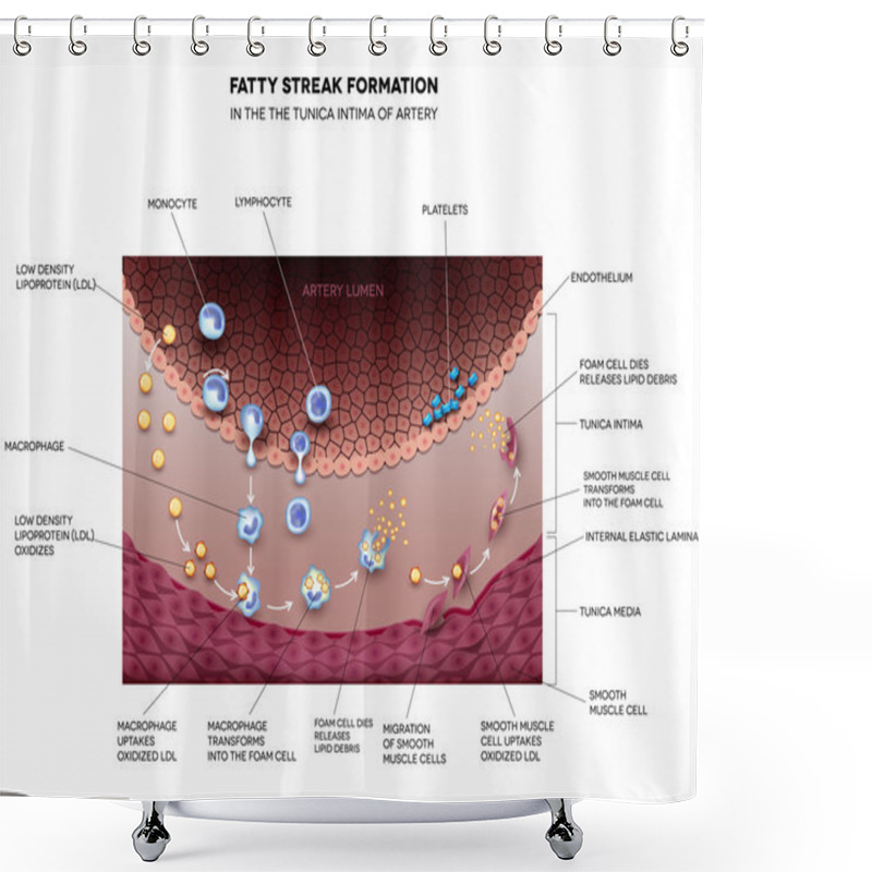 Personality  Fatty Streak Formation In The Artery Shower Curtains