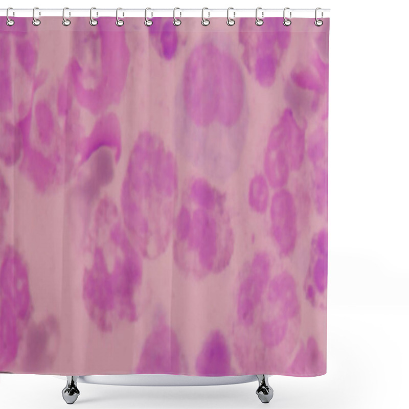 Personality  Abnormal Blood Cell Background. Shower Curtains