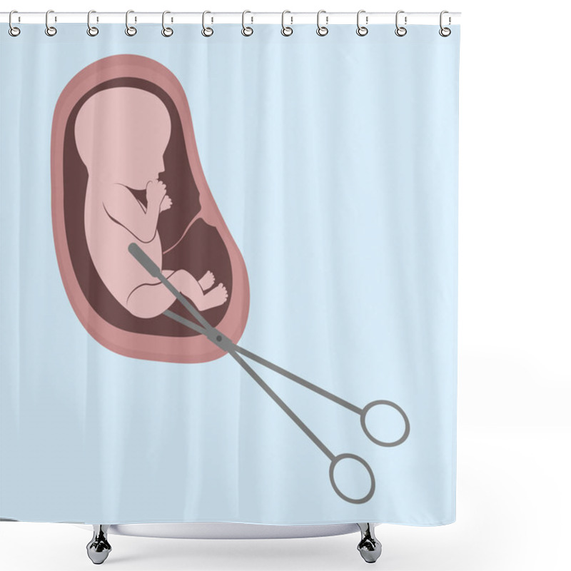 Personality  An Embryo In The Womb And Surgical Scissors. Abortion Is A Personal Decision Of Each Person. Flat Vector Illustration. Concept Of Abortion. Shower Curtains