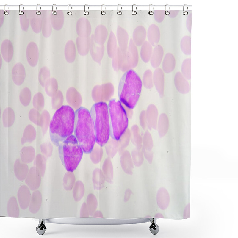 Personality  Lymphoblast Shower Curtains