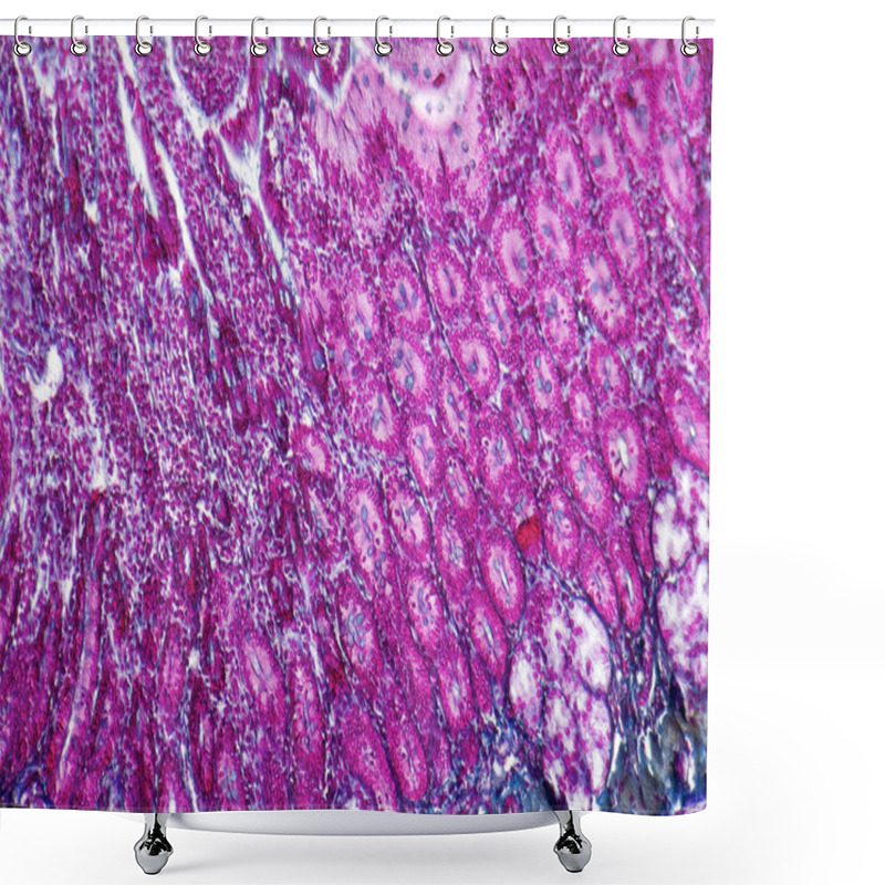 Personality  Duodenum Cross Section Shower Curtains