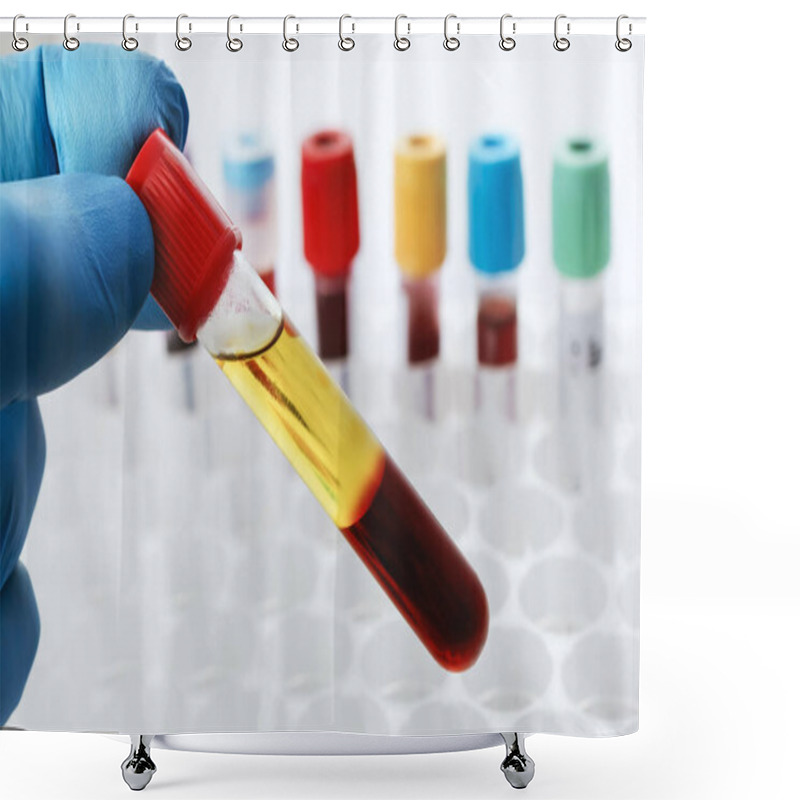 Personality  Blood Drawn From A Patient With Serum Separate In The Chemistry Laboratory. Lab Technician Holding A Test Tube Of Blood Sample After Being Centrifuged Shower Curtains