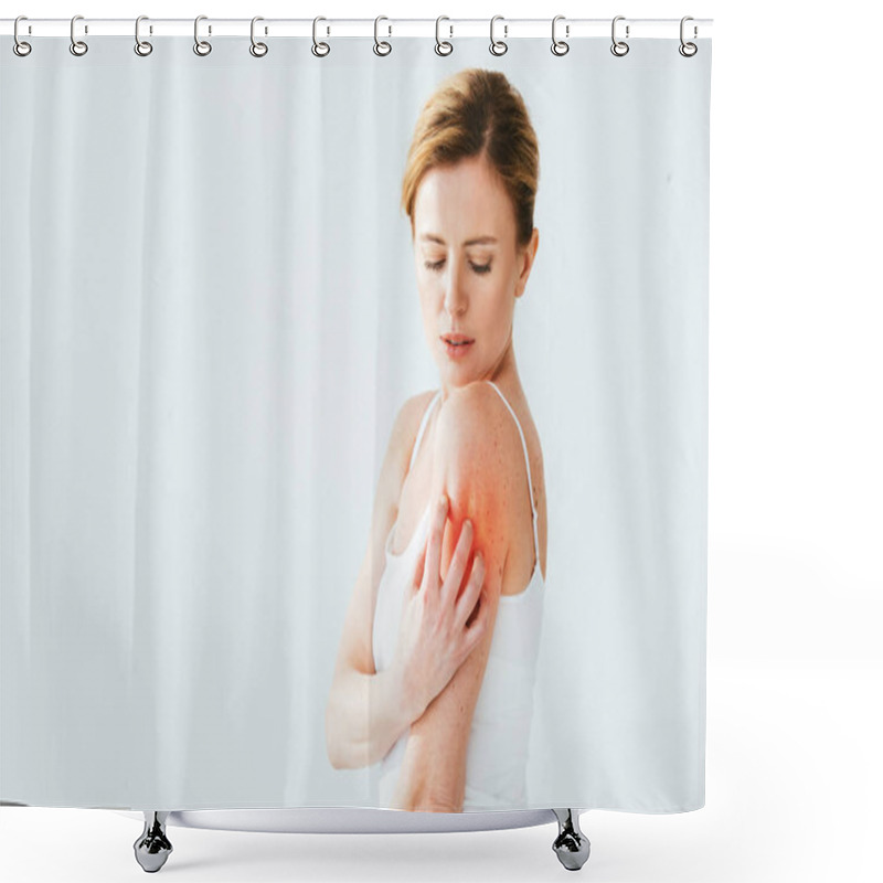 Personality  Pretty Sick Woman With Allergy Scratching Red Skin On White  Shower Curtains