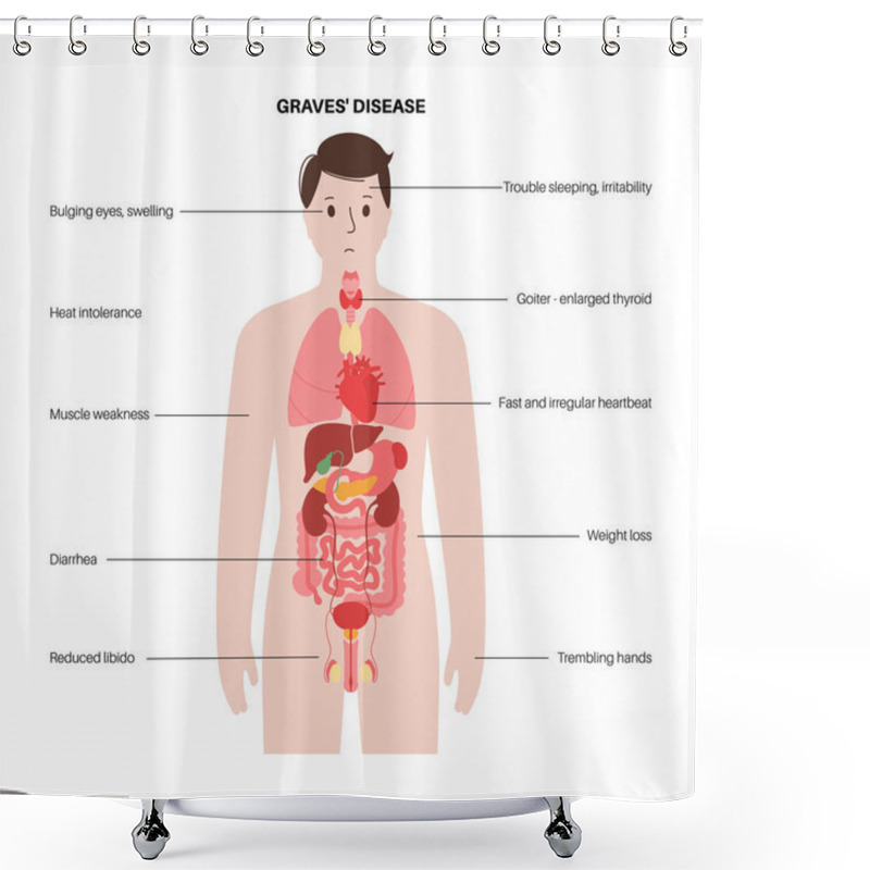 Personality  Graves Desease Symptoms Shower Curtains