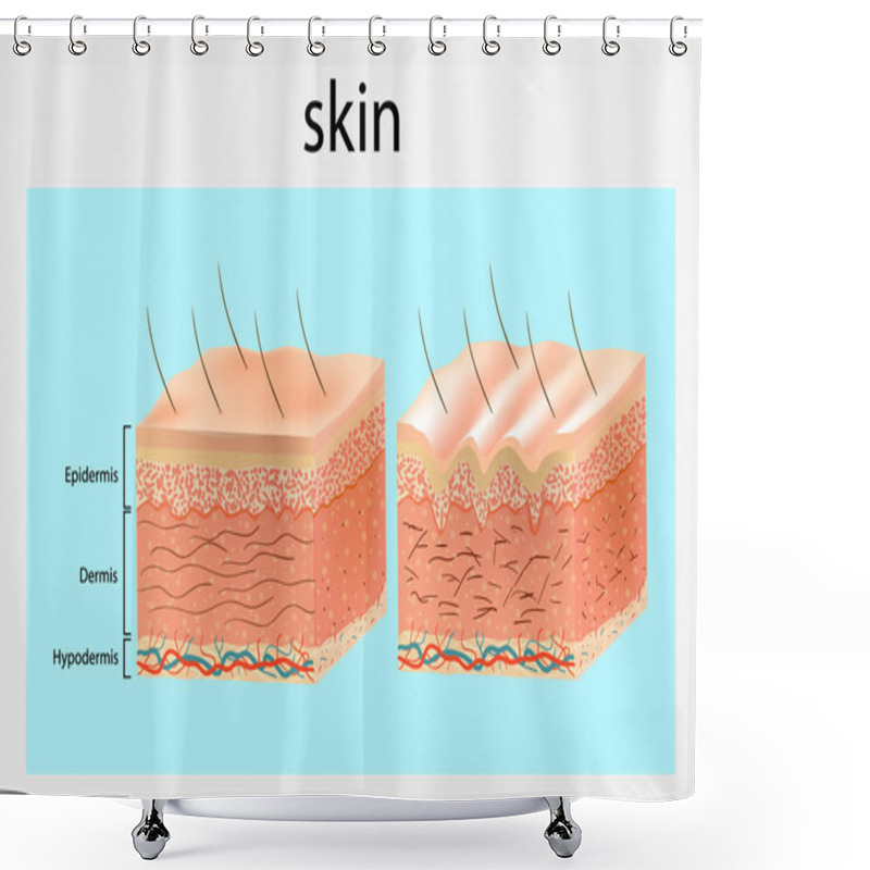 Personality  The Structure Of The Skin. Younger Skin And Aging Skin. Vector Diagram Shower Curtains