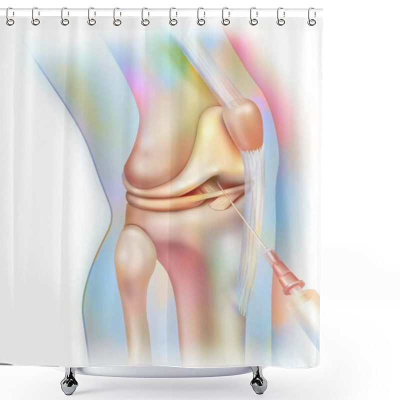 Personality  Knee Joint, Arthrography: Injection Of Contrast Product To Make Structures Visible On The Radio. Shower Curtains