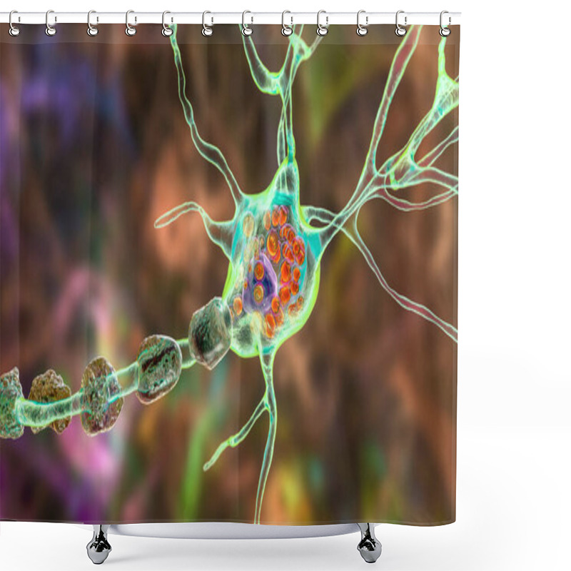 Personality  Brain Neurons In Lysosomal Storage Diseases, Tay-Sachs, Niemann-Pick, Fabry And Other. 3D Illustration Showing Swollen Neurons With Lamellar Inclusions Due To Accumulation Of Gangliosides In Lysosomes Shower Curtains