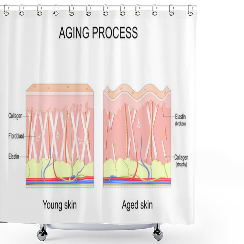 Personality  Aging Process. Comparison Of Young And Aged Skin. Collagen, Elastin And Fibroblasts In Younger And Older Skin. Age-related Changes In The Skin When Collagen Fibers Atrophy, And Elastin Broken. Vector Illustration Shower Curtains