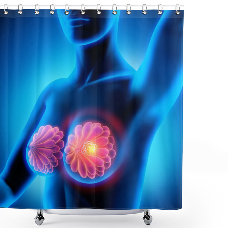 Personality  Breast Cancer - Female Anatomy - Pain Concep Shower Curtains