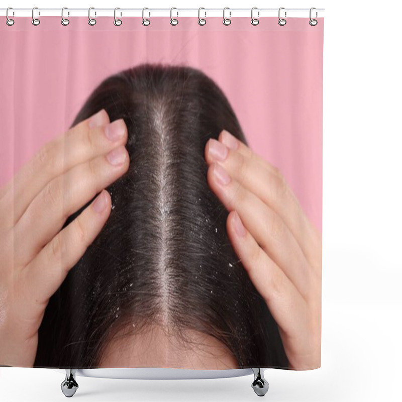 Personality  Woman With Dandruff Problem On Pink Background, Closeup Shower Curtains