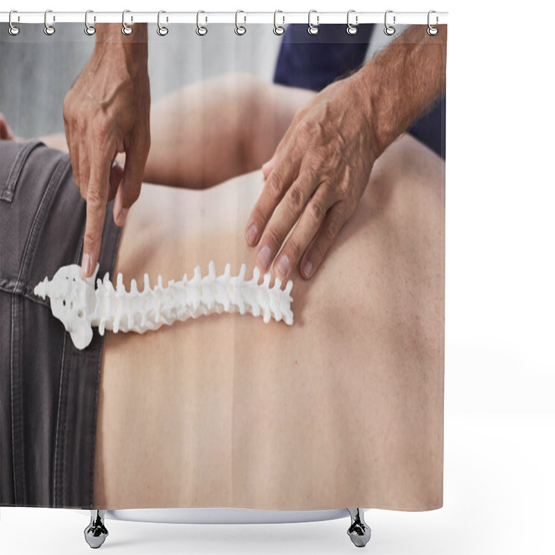 Personality  Constructions Of Lumbosacral Spine On Example Of Plastic Sample Shower Curtains