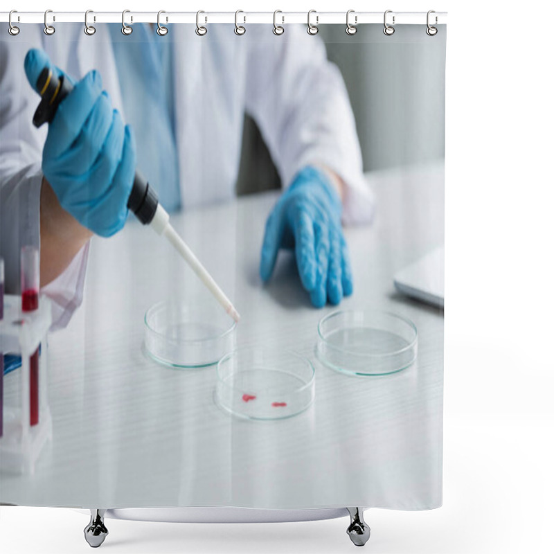 Personality  Cropped View Of Blurred Scientist In Latex Gloves Working With Electronic Pipette And Petri Dishes In Laboratory  Shower Curtains