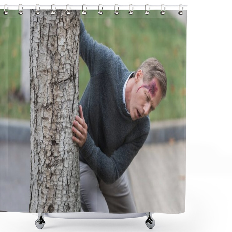 Personality  Injured Mature Man With Wound On Head Leaning On Tree On The Street Shower Curtains