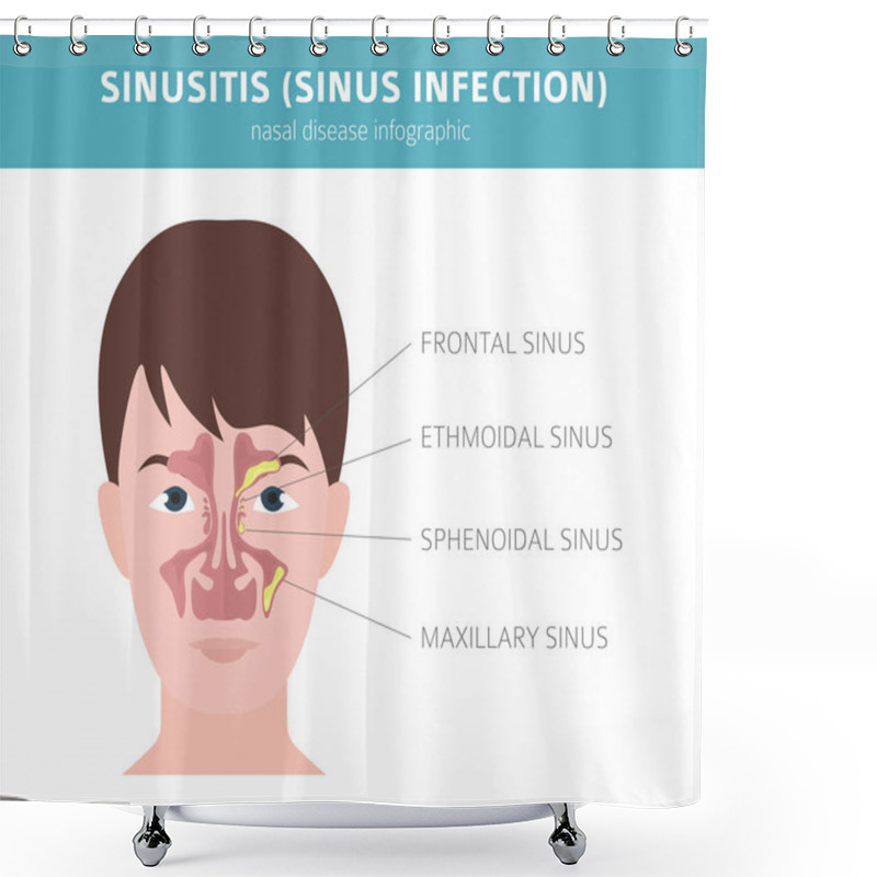 Personality  Nasal Diseases. Sinusitis, Sinus Infection Diagnosis And Treatme Shower Curtains