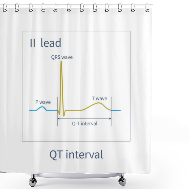 Personality  The QT Interval Of ECG Is From The Beginning Of QRS Wave To The End Of T Wave, Representing The Total Time Of Ventricular Depolarization And Repolarization. Shower Curtains