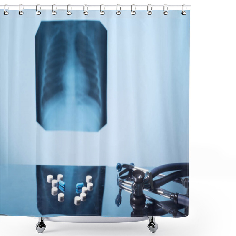 Personality  Tuberculosis Treatment Concept. X-ray Of The Lungs, With Pathology, Phonendoscope With Pills On The Table. Shower Curtains