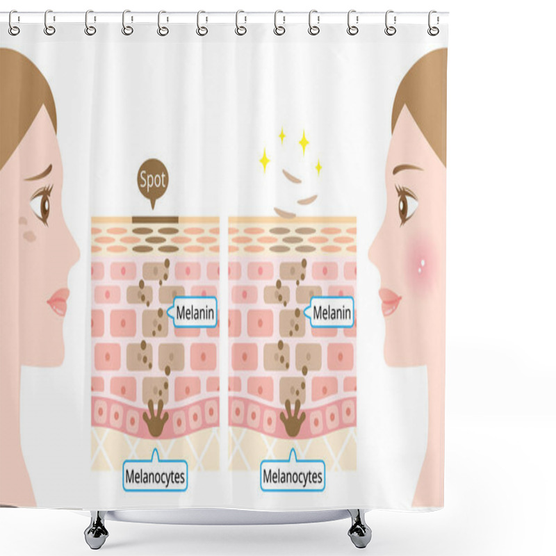 Personality  Mechanism Of Skin Cell Turnover Illustration. Melanin And Melanocytes In Human Skin Layer With Woman Face. Beauty And Skin Care Concept Shower Curtains