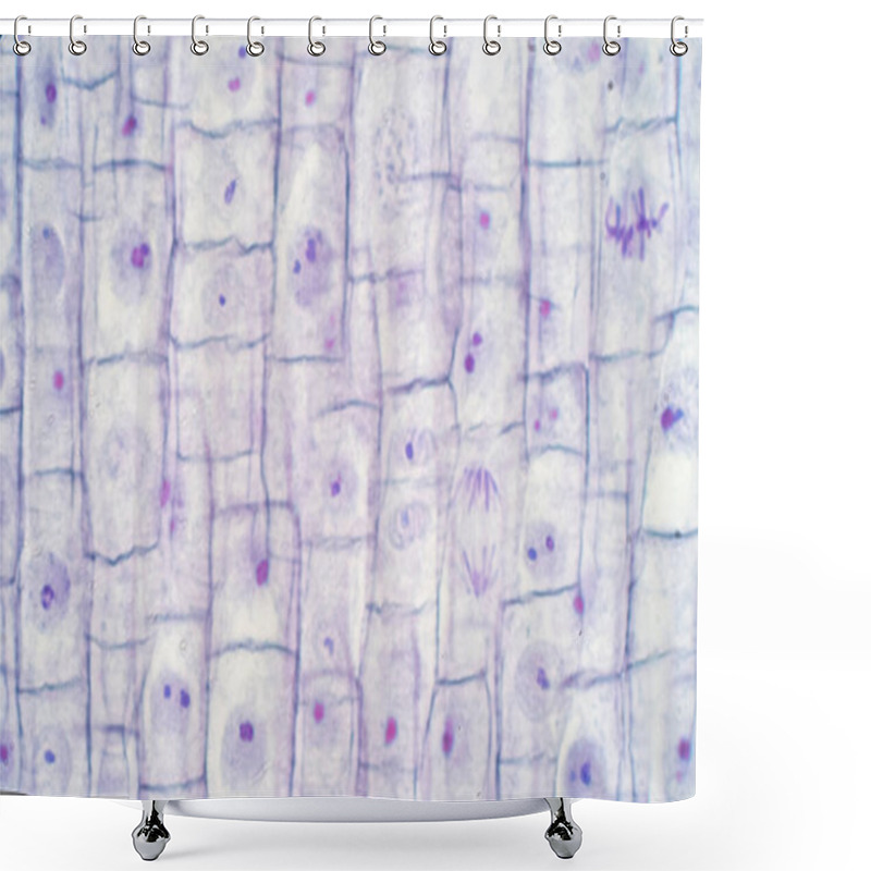 Personality  Root Tip Of Onion And Mitosis Cell In The Root Tip For Education Shower Curtains