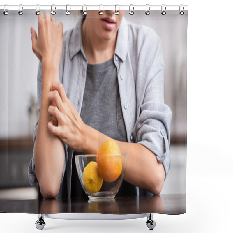 Personality  Cropped View Of Woman Scratching Hand Near Glass Bowl With Fruits  Shower Curtains