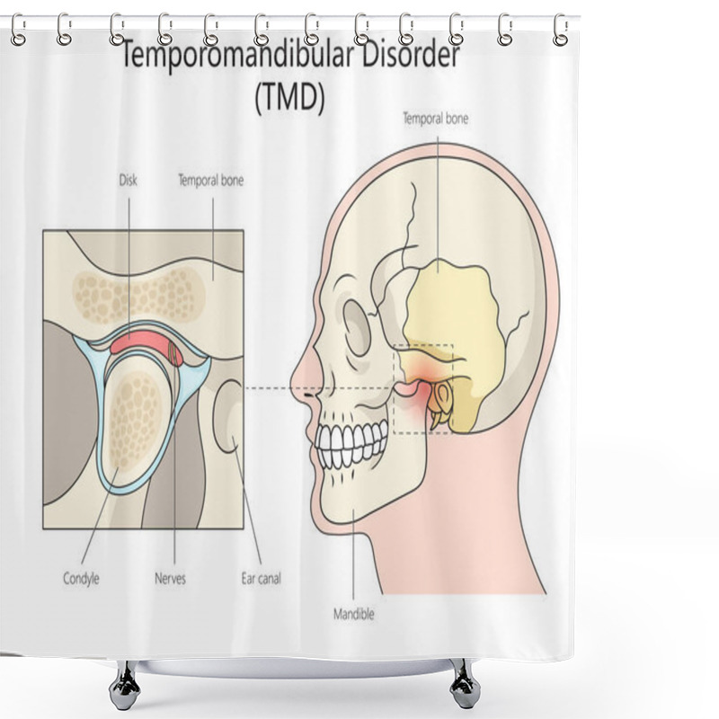 Personality  Human Temporomandibular Disorder Diagram Hand Drawn Schematic Vector Illustration. Medical Science Educational Illustration Shower Curtains